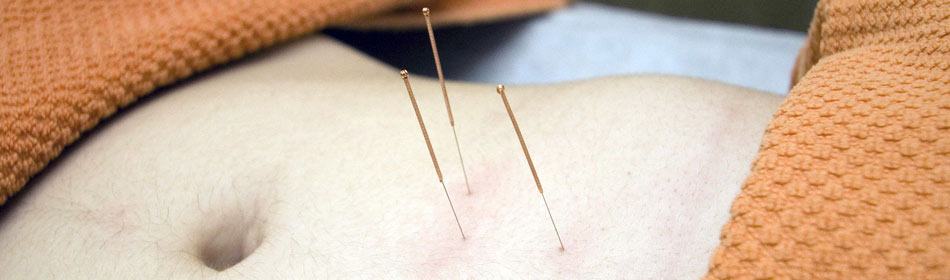 Accupuncture, Eastern Healing Arts in the Langhorne, Bucks County PA area